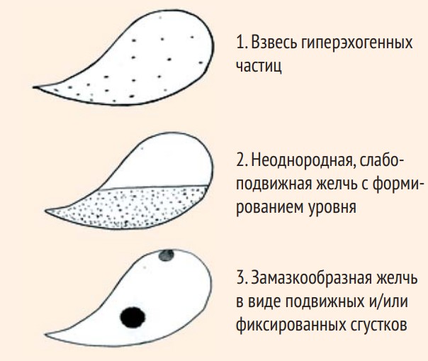 Причины сладжа Причины сладжа